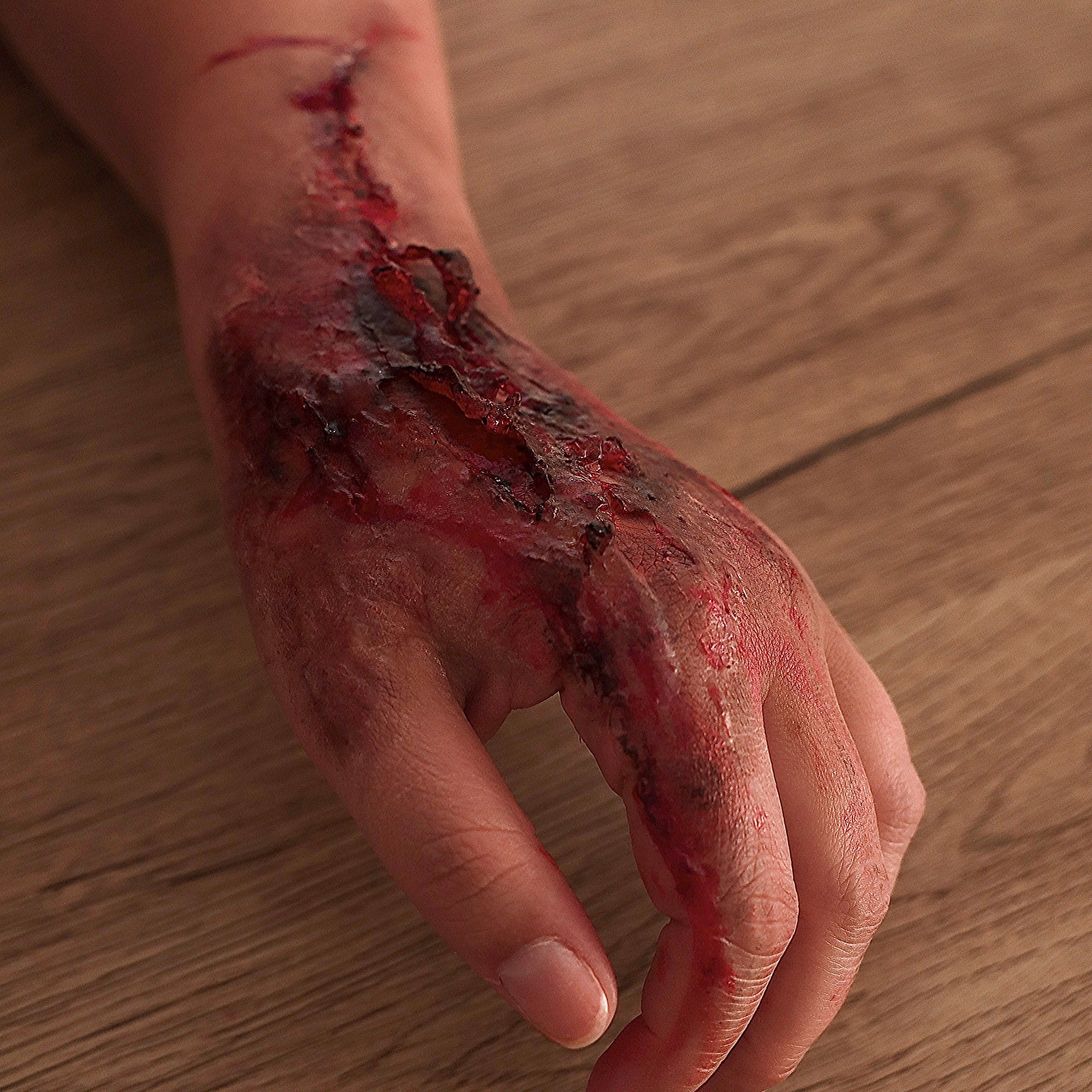 SFX Gelatine Burns